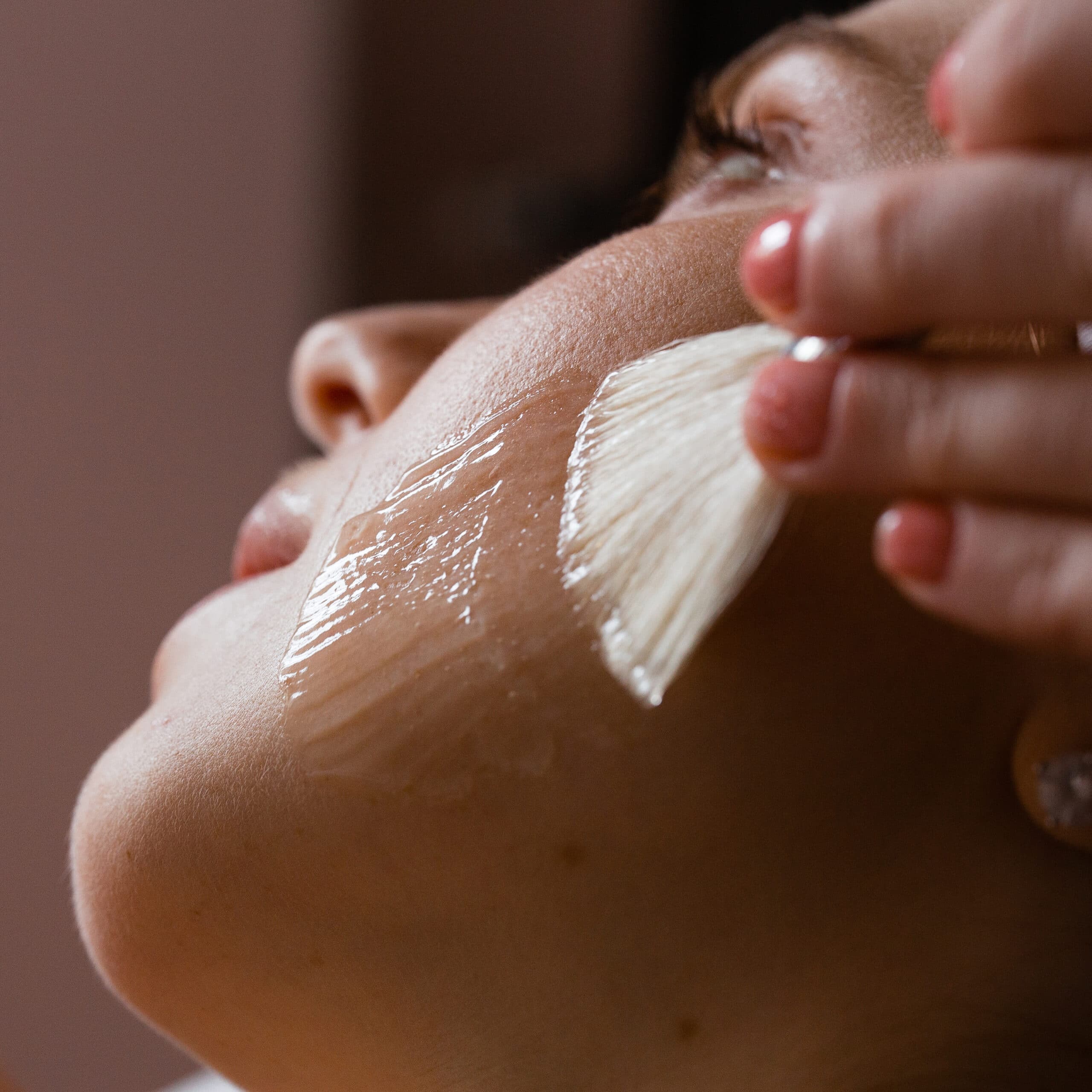 Chemical Peel Treatment