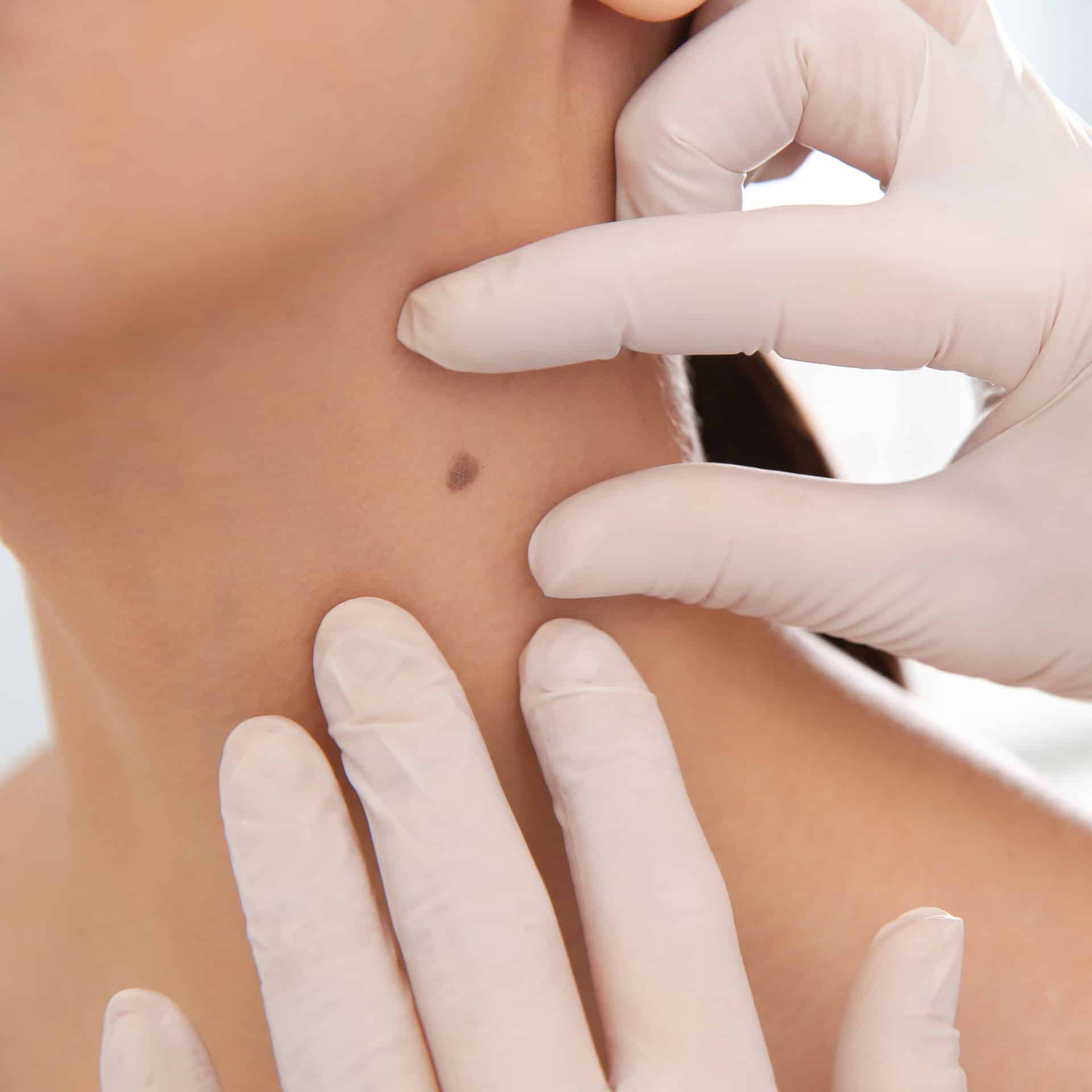 skin exam